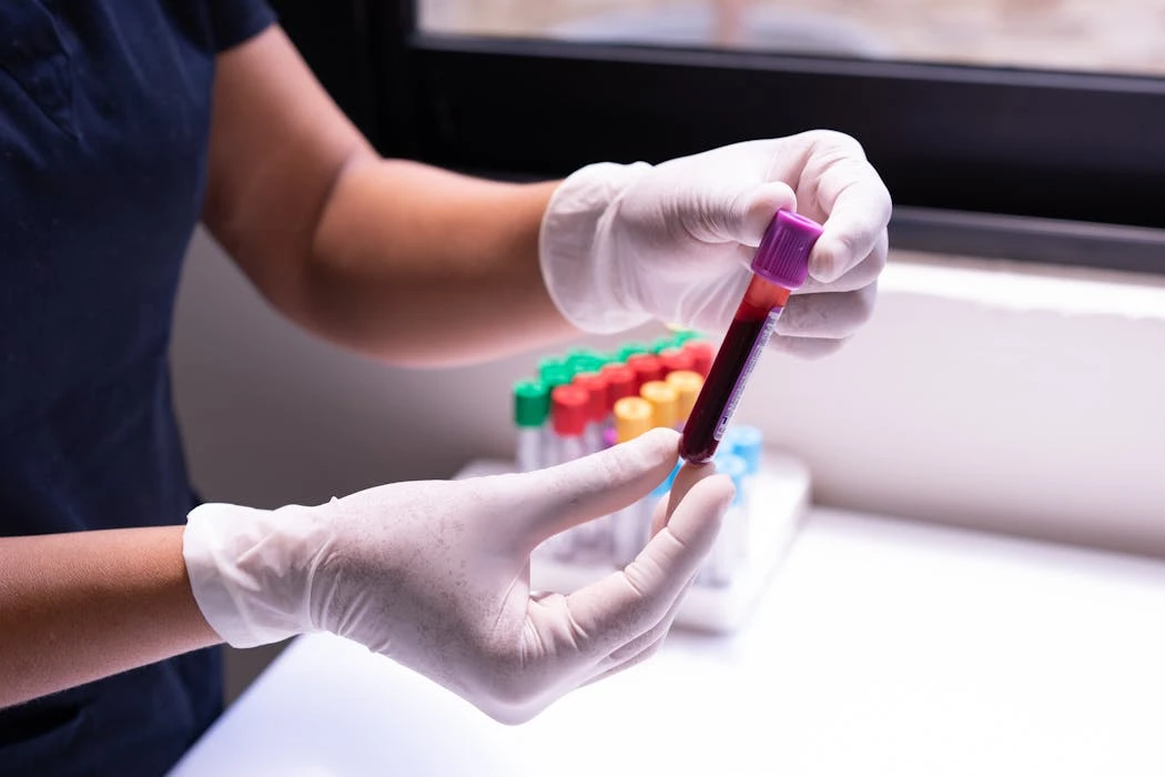 Gloved hands carefully handling a blood sample in a medical or laboratory environment.