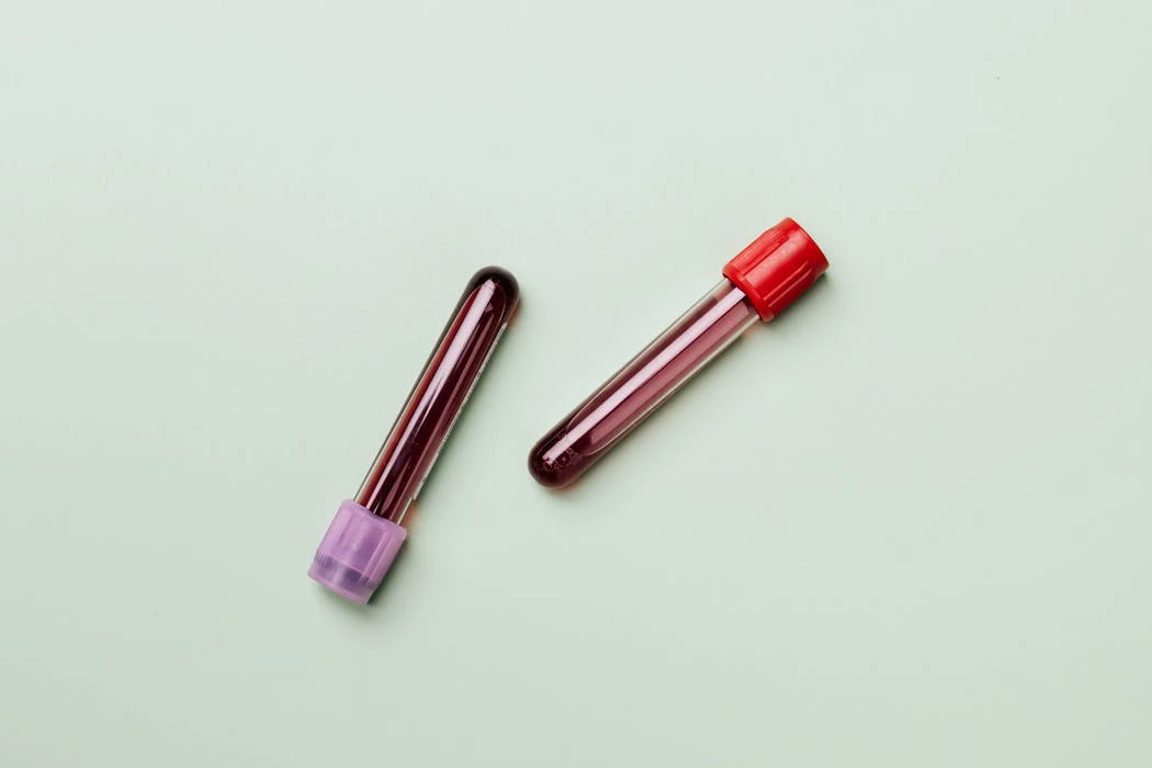 Blood samples in test tubes on a light background, ideal for medical and laboratory themes.